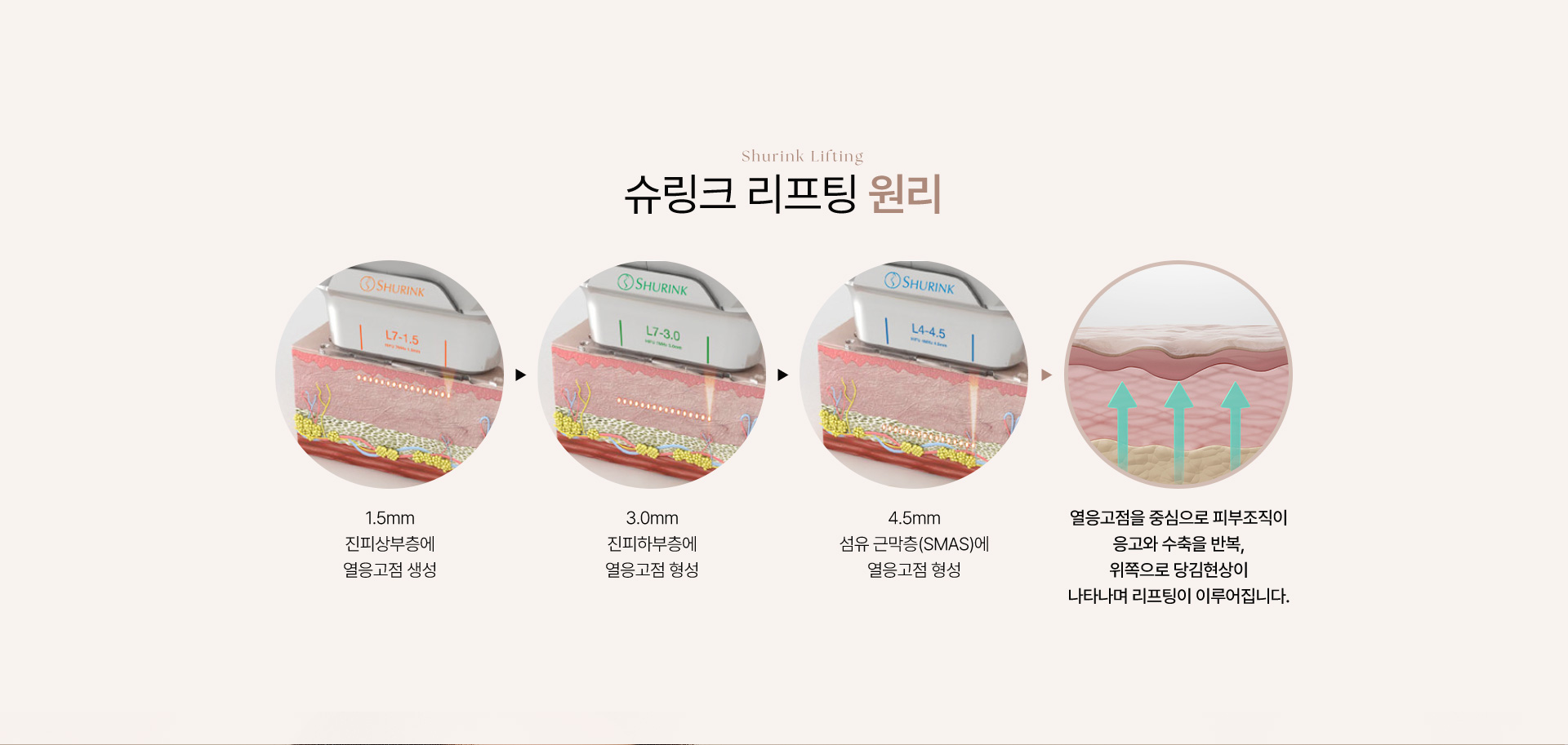청담쟈스민라인의원 슈링크